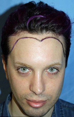 بالصور.. رجل ينفق أكثر من 50 ألف دولار ليصبح شخصًا خياليًا