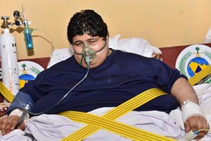 الصحة السعودية مريض السُّمنة مصاب بداء الفيل وعلاجه يستمر 3 سنوات