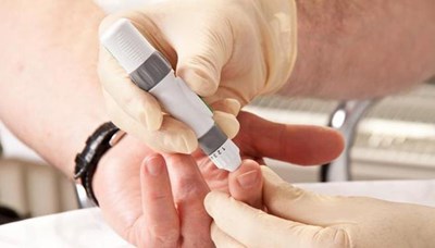 2- تتكون الكليتان من عدة أوعية دموية صغيرة تعمل كمصفاة تحتفظ بالمواد الضرورية للجسم وتتخلص من السموم. لذلك، فإن الحفاظ على نسبة سكر مستقرة ضروري، لأنه يضر بالأوعية الدموية. 