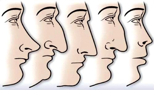 وصف الصورة