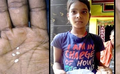 شاهد .. حالة فريدة.. فتاة تبكي دموعاً من قطن 2 شاهد.. حالة فريدة.. فتاة تبكي دموعاً من قطن