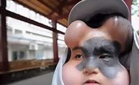 بالصورة .. أغرب رأس فتاة في العالم! 2 شاهد .. أغرب رأس فتاة في العالم!