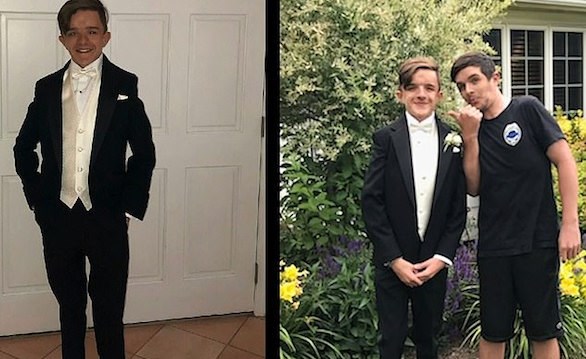 جراحة رائدة تنقذ حياة شاب من تشوه قاتل