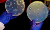 دراسة: أكثر من 1.2 مليون وفاة نتيجة عدوى ببكتيريا مقاومة للأدوية في 2019