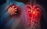دراسة: "كوفيد 19" مرتبط بضعف في وظائف القلب