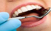 هل تتأثر عمليات حشو عصب الأسنان في أمريكا بسبب الحرب في أوكرانيا؟