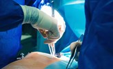 إجراء 4 عمليات قلب مفتوح لأطفال رُضّع خلال 5 أيام في السعودية